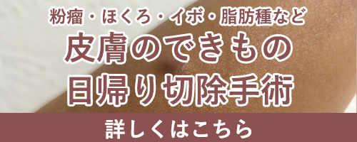 皮膚のできもの（粉瘤・いぼ・ほくろ・脂肪腫）の日帰り切除手術